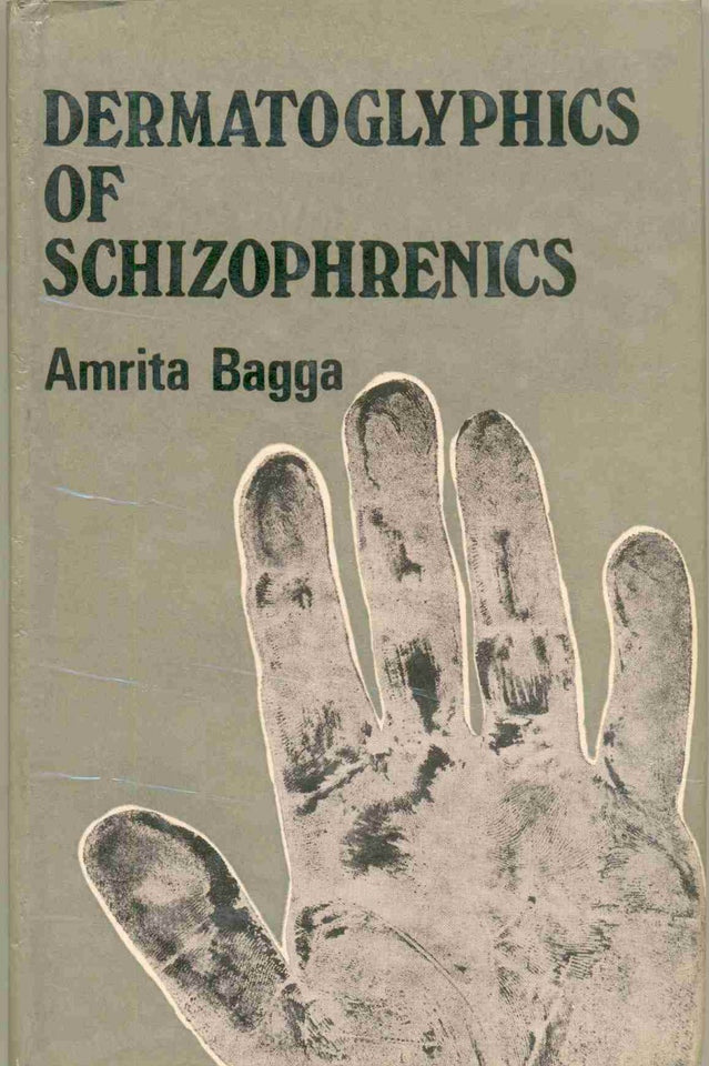 Dermatoglyphics Of Schizophrenics