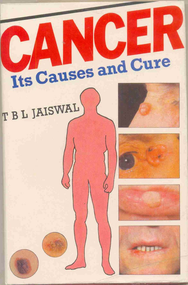 Cancer, Its Causes And Cure